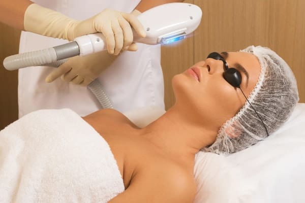 IPL skin rejuvenation Limerick